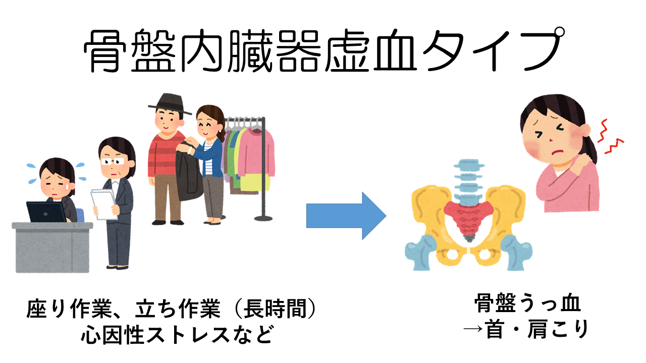 骨盤内臓器虚血タイプの首・肩こり