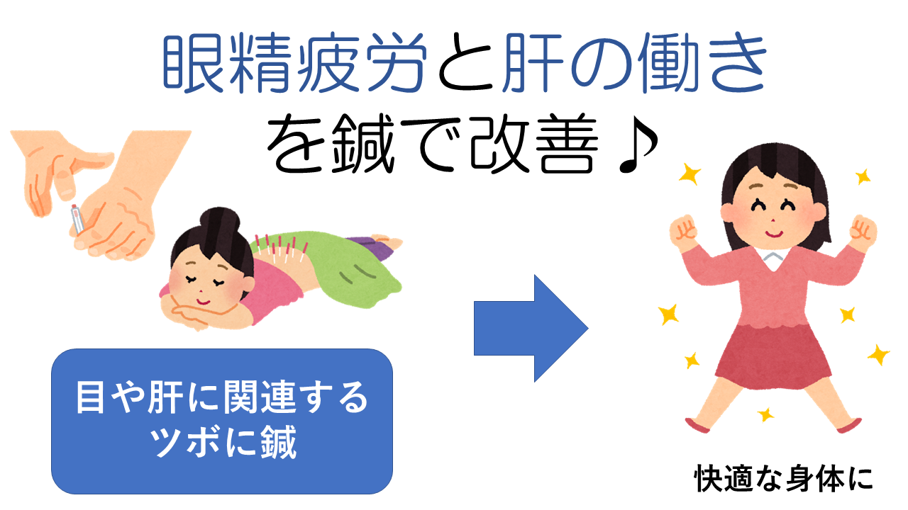 鍼で眼精疲労解消
