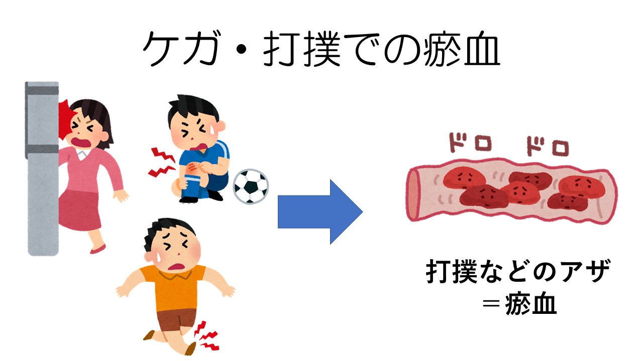 ケガによる瘀血