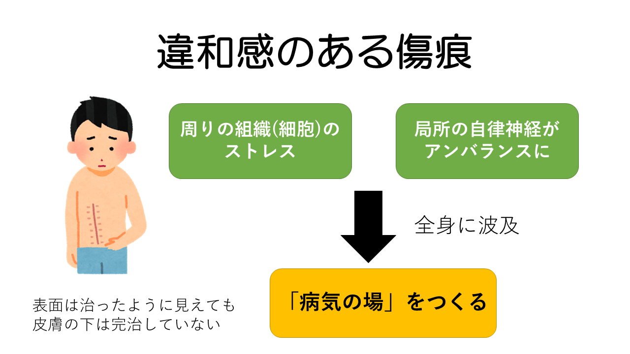 違和感のある傷痕