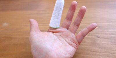 【症例】指先切断による感覚障害と腕の痺れ