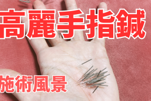【施術風景動画】高麗手指鍼（手の鍼）