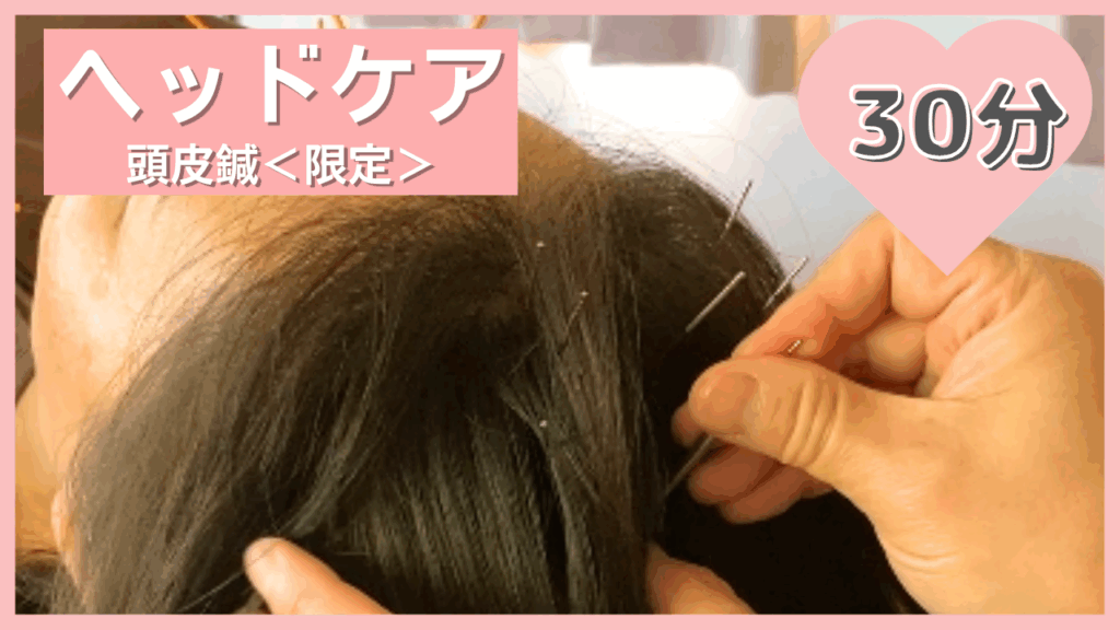 頭皮鍼 頭の鍼