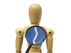 投稿についてもっと詳しく 【症例】側弯症