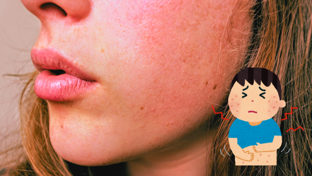 あなたが現在見ているのは 【症例】全身のアトピー(激しい炎症）