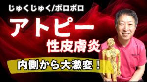 投稿についてもっと詳しく 【症例】アトピー性皮膚炎｜脱ステロイド併用