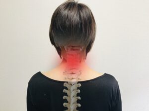 投稿についてもっと詳しく 【症例】重症ストレートネック