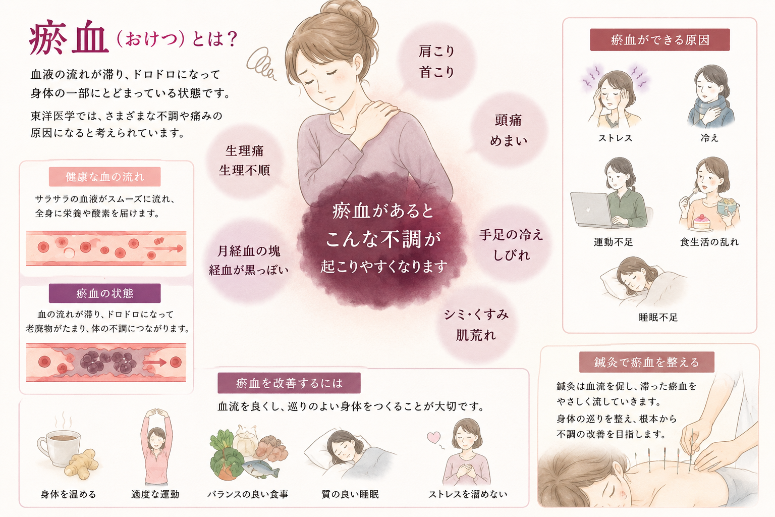 あなたが現在見ているのは 瘀血（おけつ）とは？｜東洋医学で考える身体の不調と鍼灸